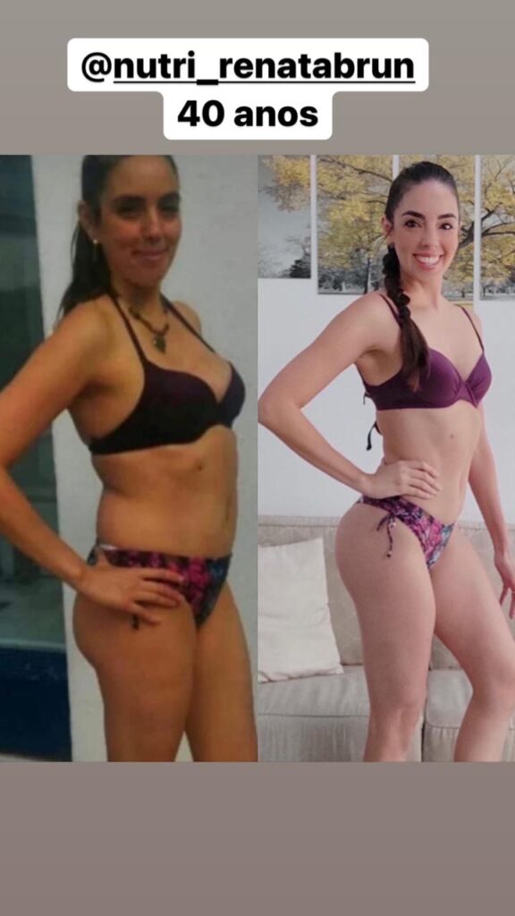 Antes e Depois (20)